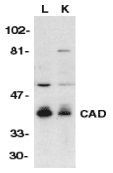 Anti-CAD antibody used in Western blot. GTX74349