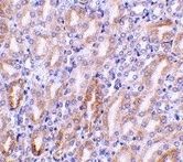 Anti-CAD antibody used in IHC (Formalin-fixed paraffin-embedded sections). GTX74349