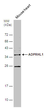 Anti-ADPRHL1 antibody used in Western blot. GTX120706