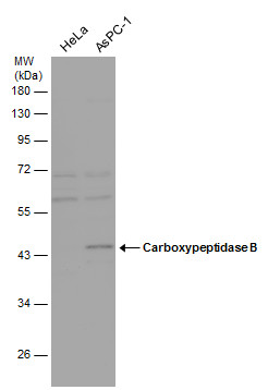 Anti-Carboxypeptidase B antibody [N1C1] used in Western blot. GTX105170