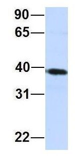 Anti-CARKD antibody, Internal used in Western blot. GTX46301