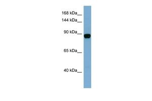 Anti-CASD1 antibody, N-term used in Western blot. GTX45999