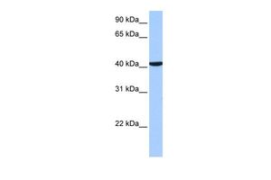 Anti-CC2D1B antibody, C-term used in Western blot. GTX45782