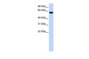 Anti-CCDC11 antibody, N-term used in Western blot. GTX45274