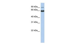Anti-CCDC128 antibody, N-term used in Western blot. GTX45622