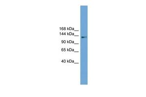 Anti-CCDC146 antibody, Internal used in Western blot. GTX44903