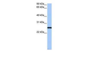 Anti-CCDC46 antibody, C-term used in Western blot. GTX45452