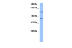 Anti-CCDC78 antibody, Internal used in Western blot. GTX45581