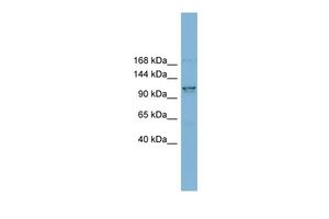 Anti-CCDC87 antibody, N-term used in Western blot. GTX44961