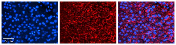Anti-CCPG1 antibody, Internal used in IHC (Formalin-fixed paraffin-embedded sections). GTX46434