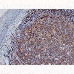 Anti-CD45RA antibody [F8-11-13] used in IHC (Formalin-fixed paraffin-embedded sections). GTX76664