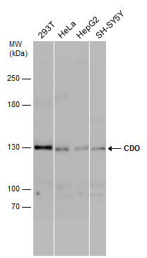 Anti-CDO antibody [N1N2], N-term used in Western blot. GTX105422