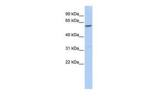 Anti-CEACAM16 antibody, Internal used in Western blot. GTX46613