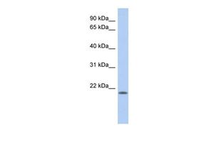 Anti-CHAC2 antibody, N-term used in Western blot. GTX45099