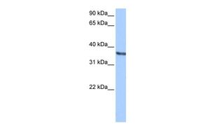 Anti-CHAD antibody, Internal used in Western blot. GTX45818