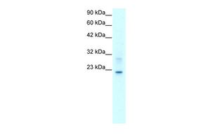 Anti-Claudin 9 antibody, C-term used in Western blot. GTX77838