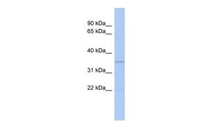 Anti-CLEC4G antibody, N-term used in Western blot. GTX45168