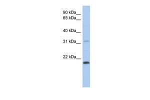 Anti-CLECL1 antibody, Internal used in Western blot. GTX45589