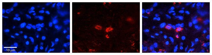 Anti-CLN6 antibody, C-term used in IHC (Formalin-fixed paraffin-embedded sections). GTX46318