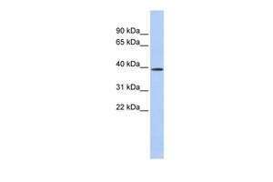 Anti-CLN6 antibody, Internal used in Western blot. GTX46319