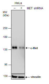 Anti-c-Met antibody [GT1586] used in Western blot. GTX631993