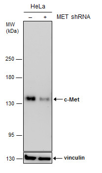 Anti-c-Met antibody [GT556] used in Western blot. GTX631992