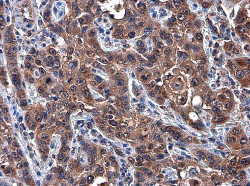 Anti-c-Met antibody [GT556] used in IHC (Formalin-fixed paraffin-embedded sections). GTX631992