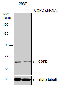 Anti-COPD antibody used in Western blot. GTX103252