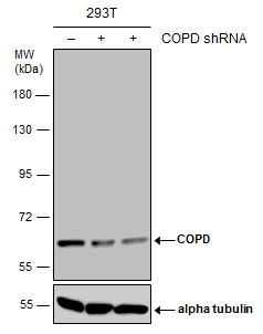Anti-COPD antibody [GT1318] used in Western blot. GTX630562