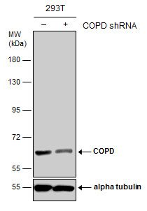 Anti-COPD antibody [GT189] used in Western blot. GTX630561
