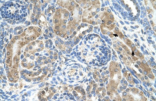Anti-CRELD1 antibody, C-term used in IHC (Formalin-fixed paraffin-embedded sections). GTX46585