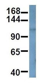 Anti-ANKRD27 antibody, C-term used in Western blot. GTX48931