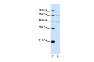 Anti-CRELD1 antibody, C-term used in Western blot. GTX46585