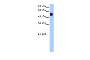 Anti-CRISPLD2 antibody, N-term used in Western blot. GTX45942