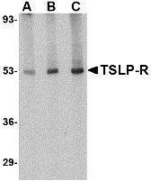 Anti-CRLF2 antibody used in Western blot. GTX85052