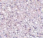 Anti-CRLF2 antibody used in IHC (Formalin-fixed paraffin-embedded sections). GTX85052