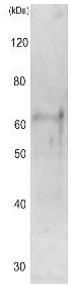 Anti-Cut15 (S. pombe) antibody used in Western blot. GTX64103