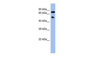 Anti-CYP11B2 antibody, Internal used in Western blot. GTX47121