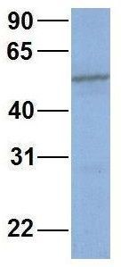 Anti-CYP2C19 antibody, Internal used in Western blot. GTX47113