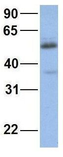 Anti-CYP2C19 antibody, Internal used in Western blot. GTX47113