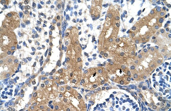 Anti-CYP4A22 antibody, N-term used in IHC (Formalin-fixed paraffin-embedded sections). GTX47105