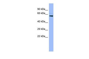 Anti-CYP4A22 antibody, N-term used in Western blot. GTX47104