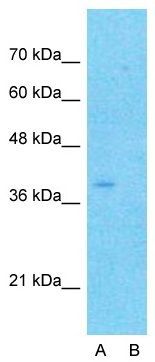 Anti-CYTB antibody, N-term used in Western blot. GTX45884