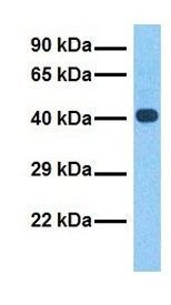 Anti-CYTB antibody, N-term used in Western blot. GTX45884