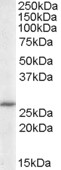 Anti-ANP32B antibody, C-term used in Western blot. GTX89831