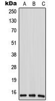 Anti-ANP32D antibody used in Western blot. GTX55938