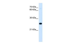 Anti-ANTP antibody, C-term used in Western blot. GTX46280
