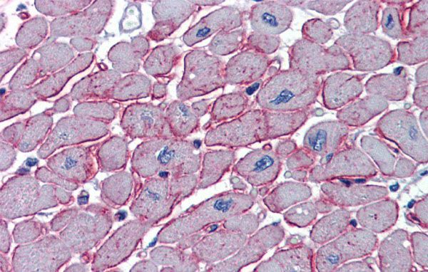 Anti-DCST1 antibody, C-term used in IHC (Formalin-fixed paraffin-embedded sections). GTX46888