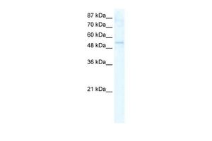 Anti-DDX19A antibody, N-term used in Western blot. GTX47506