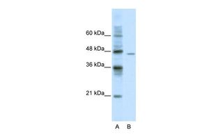Anti-DDX25 antibody, C-term used in Western blot. GTX47517
